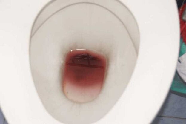 repérer les hommes quand ils sont excités